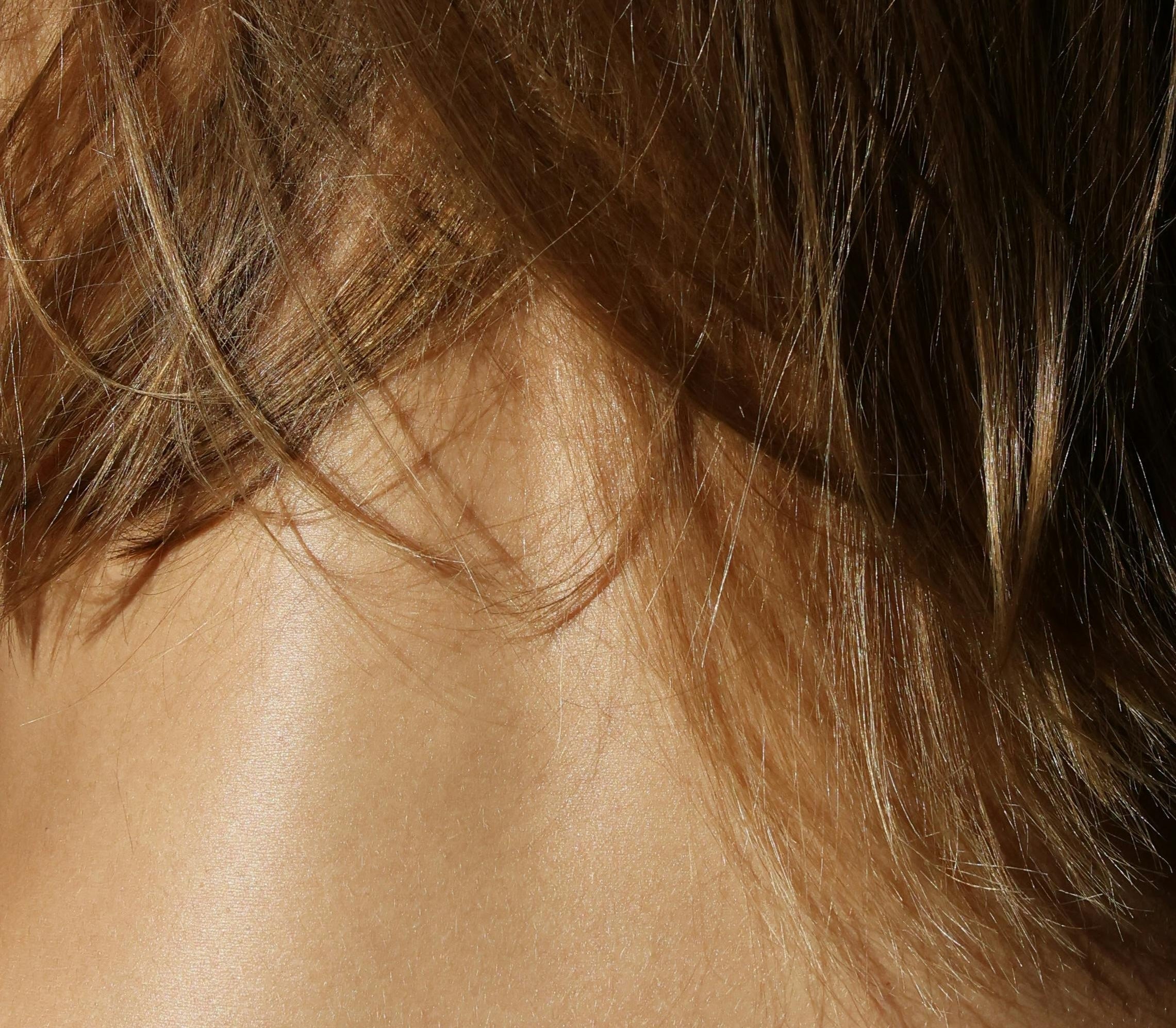 Hydrolytic® Scalp Treatment
