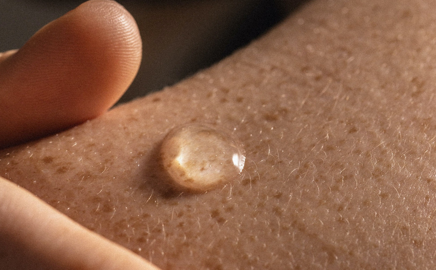 a droplet of the fjör hydrolytic serum on skin with freckles and a hand