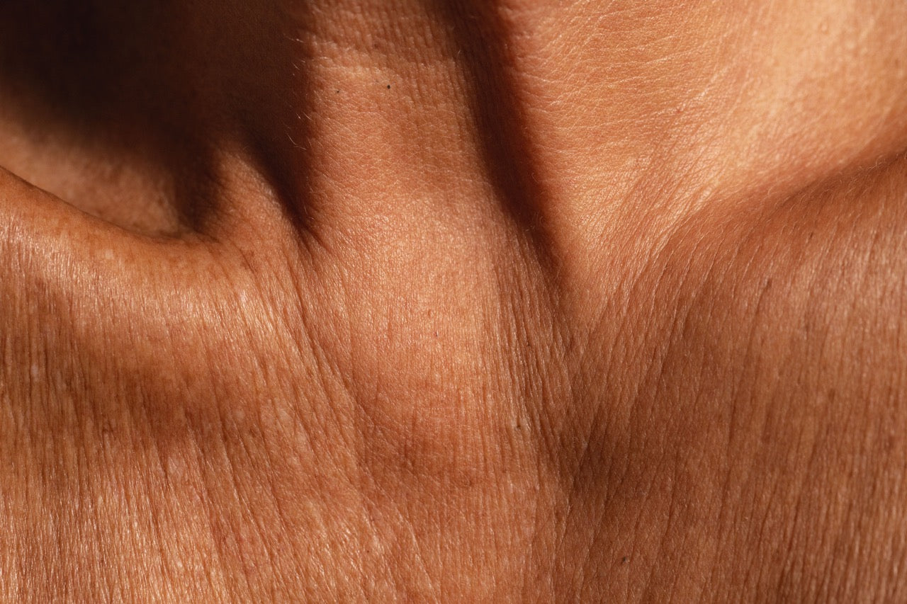 a close up shot of a chest with maturing skin