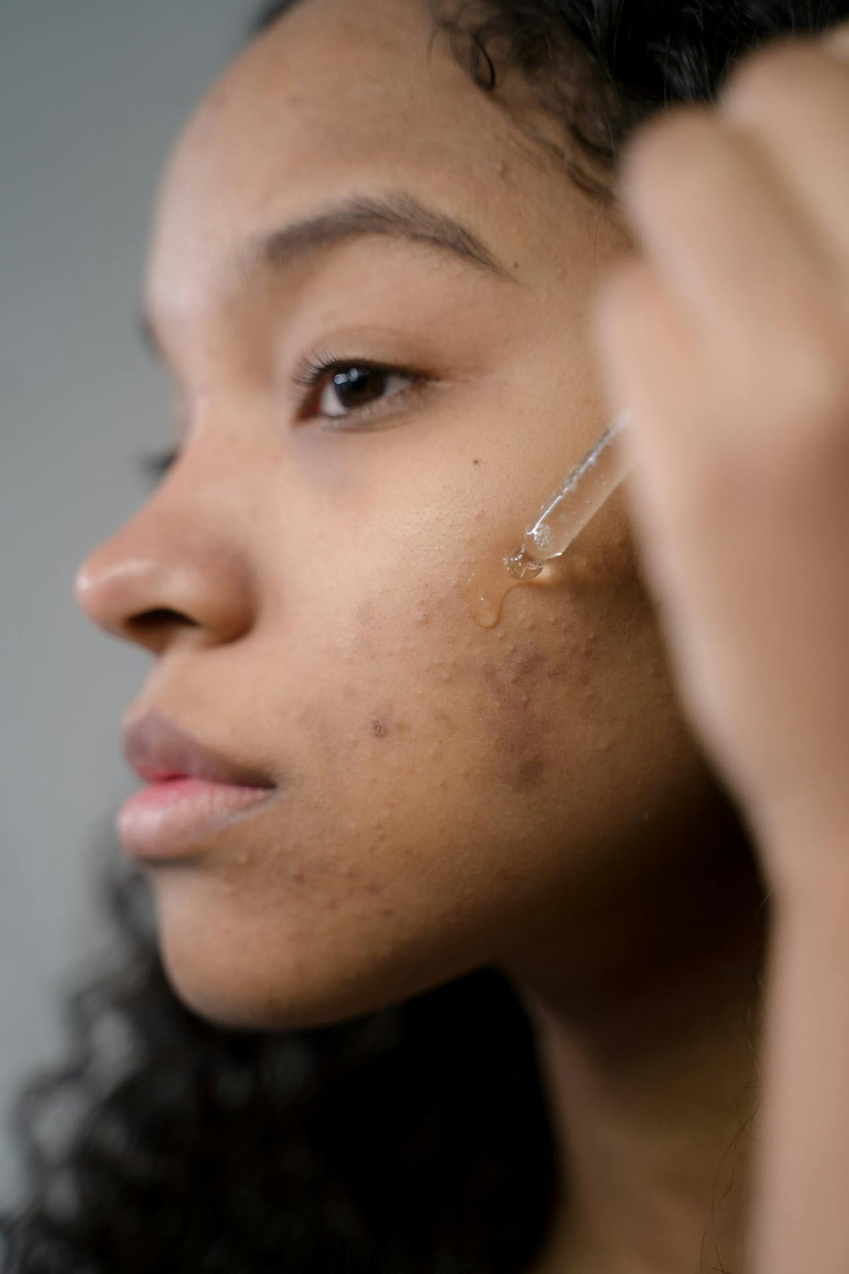 Skin Handbook: Managing Blemishes and Redness with fjör