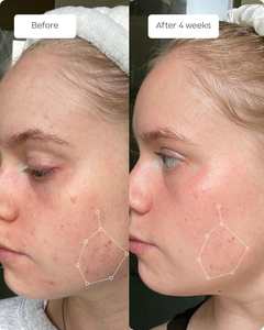 The Serum + Body Routine