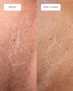 The Serum + Body Routine