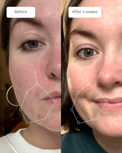The Face Routine