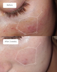 The Hydrolytic® Serum