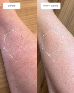 Before and after comparison of the hydrolytic body moisturizer on the forearm