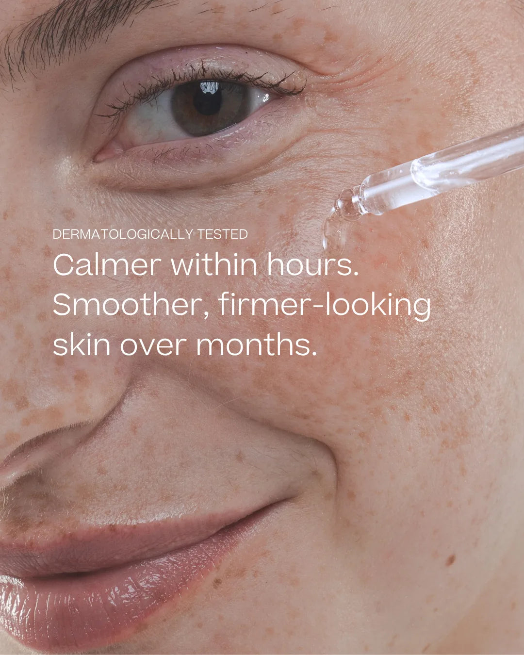 Close-up of the Hydrolytic® Serum being applied, with text: Dermatologically tested. Calmer within hours. Smoother, firmer-looking skin over months.